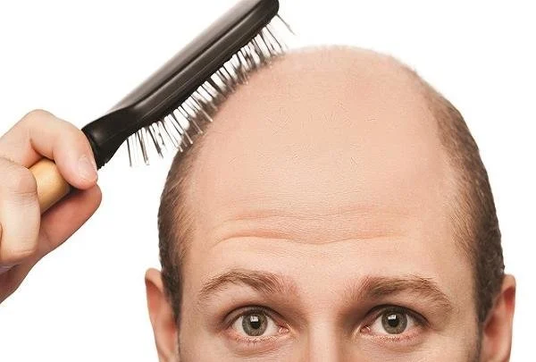 Treatment of hair loss with pills