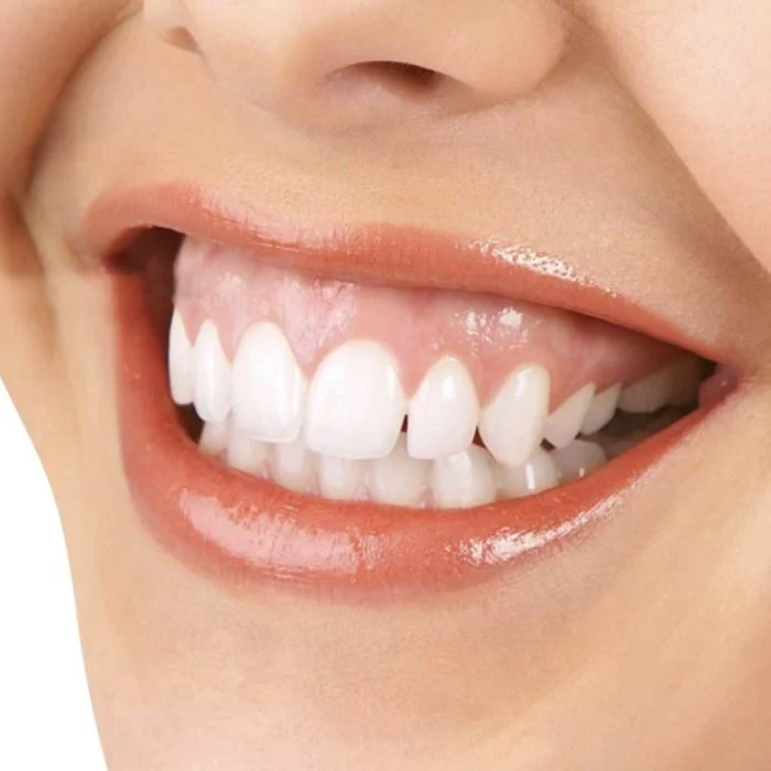 The best age for orthodontics