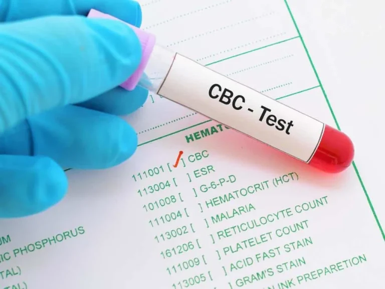 mchc پایین: علائم، علل و نحوه درمان آن