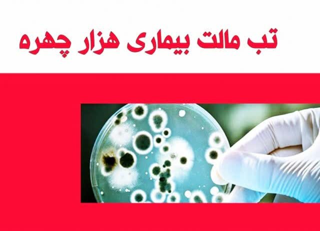 شناسایی ۶۶۸ نفر بیمار مبتلا به تب مالت در استان کردستان