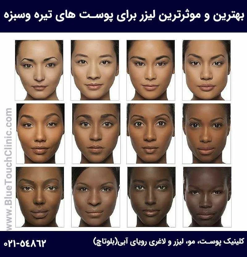 لیزر مناسب پوست سیاه