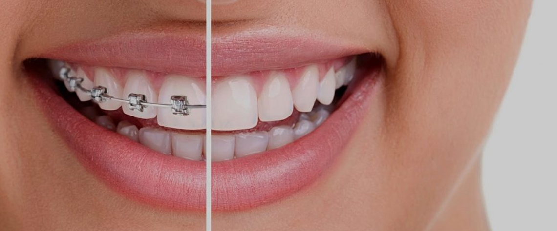 شرایط استفاده از تخفیف ها