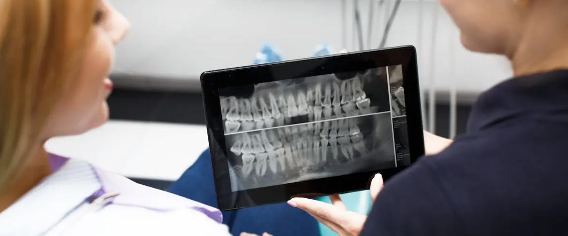 مزایای انتخاب چکاپ ارتودنسی در لیما طب